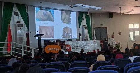 Octobre Rose : La Fondation Orange Burkina Faso alloue 100 millions de F CFA pour la lutte contre les cancers féminins
